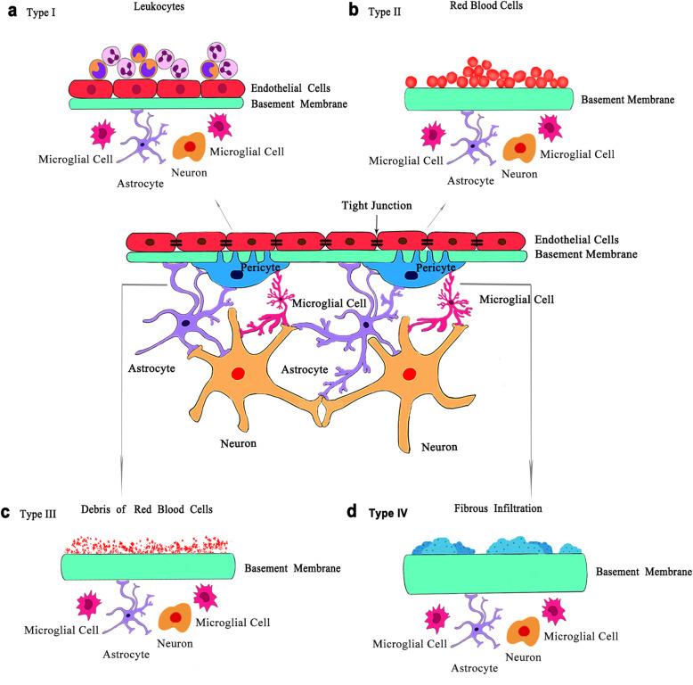 https://cdn.ncbi.nlm.nih.gov/pmc/blobs/0ab5/8088070/352947a8c3a0/40662_2021_239_Fig2_HTML.jpg