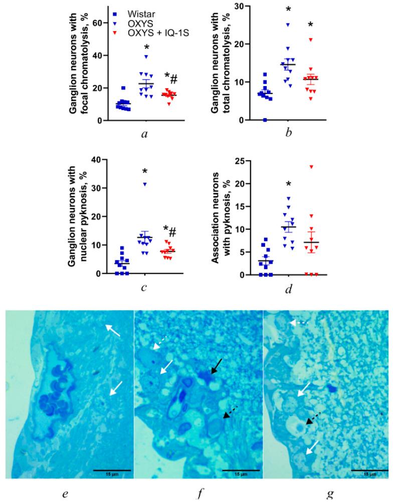 https://cdn.ncbi.nlm.nih.gov/pmc/blobs/0ab7/12190811/2b7a2ec5618c/cells-14-00896-g003.jpg