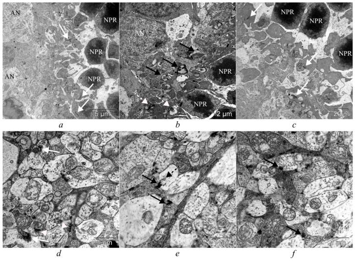 https://cdn.ncbi.nlm.nih.gov/pmc/blobs/0ab7/12190811/569d876a739a/cells-14-00896-g004.jpg