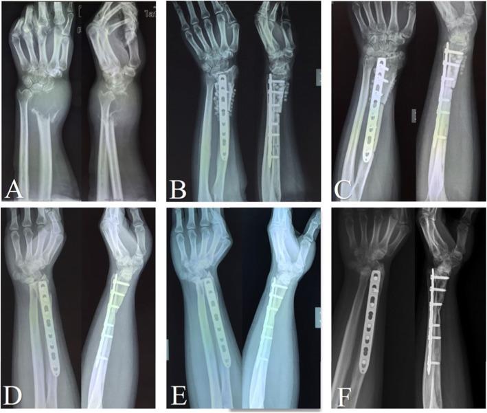 https://cdn.ncbi.nlm.nih.gov/pmc/blobs/0abb/6998256/4017a3eaf503/12891_2020_3084_Fig4_HTML.jpg