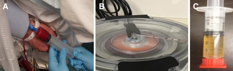 https://cdn.ncbi.nlm.nih.gov/pmc/blobs/0abb/7754610/d1ddd09af84a/gr1.jpg
