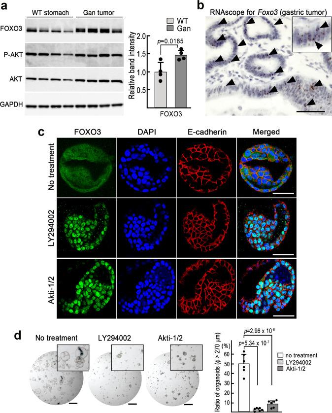 https://cdn.ncbi.nlm.nih.gov/pmc/blobs/0abb/8084732/63baf7e830e0/41388_2021_1757_Fig3_HTML.jpg