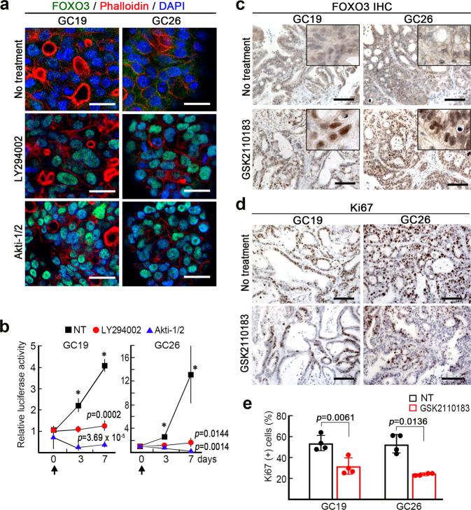https://cdn.ncbi.nlm.nih.gov/pmc/blobs/0abb/8084732/ca4b097b9eae/41388_2021_1757_Fig7_HTML.jpg