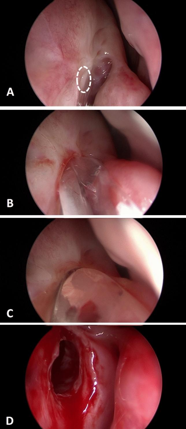 https://cdn.ncbi.nlm.nih.gov/pmc/blobs/0ac5/8273032/944472c7fddb/405_2021_6975_Fig2_HTML.jpg