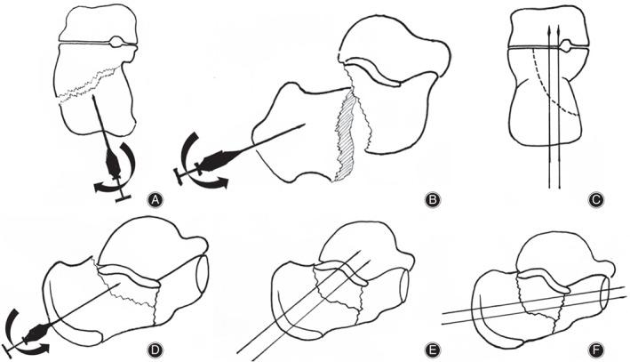 https://cdn.ncbi.nlm.nih.gov/pmc/blobs/0ac9/7862139/420484728db7/OS-13-225-g001.jpg