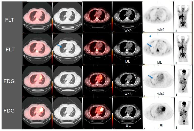 https://cdn.ncbi.nlm.nih.gov/pmc/blobs/0aca/7169847/299cadb089c9/diagnostics-10-00026-g001.jpg