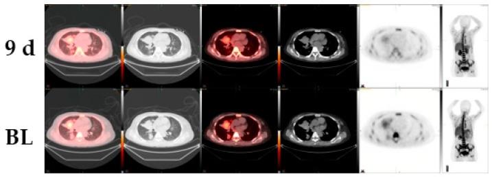 https://cdn.ncbi.nlm.nih.gov/pmc/blobs/0aca/7169847/6e53e49d3c13/diagnostics-10-00026-g003.jpg