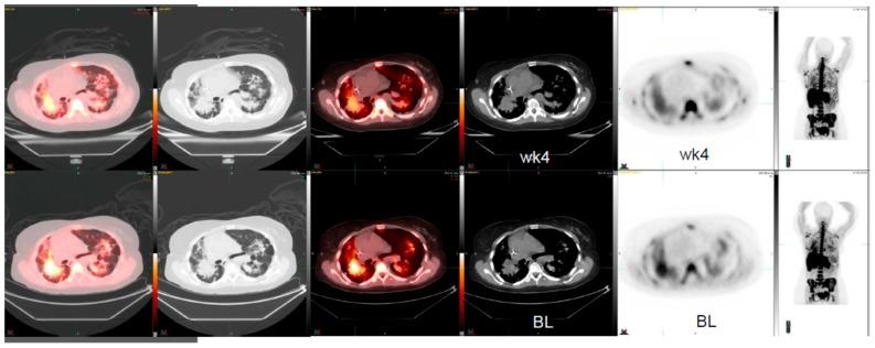 https://cdn.ncbi.nlm.nih.gov/pmc/blobs/0aca/7169847/ff2570b40789/diagnostics-10-00026-g002.jpg