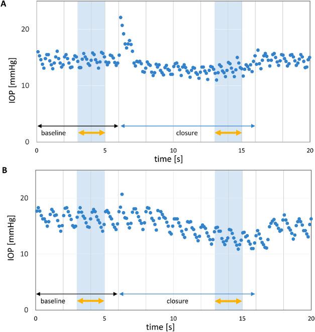 https://cdn.ncbi.nlm.nih.gov/pmc/blobs/0acc/8107486/41d193a49d4b/iovs-62-6-8-f002.jpg