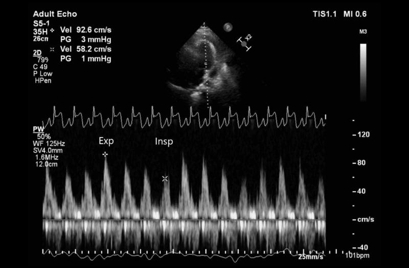 https://cdn.ncbi.nlm.nih.gov/pmc/blobs/0acf/7348211/0b04d37c6683/cureus-0012-00000009074-i04.jpg