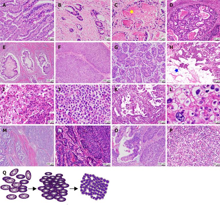 https://cdn.ncbi.nlm.nih.gov/pmc/blobs/0ad3/12305129/ae578fb90eeb/wjg-31-28-108990-g002.jpg