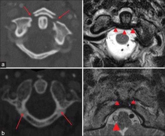 https://cdn.ncbi.nlm.nih.gov/pmc/blobs/0ad6/9910133/82ab80609d60/JCVJS-13-432-g004.jpg