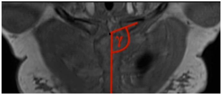 https://cdn.ncbi.nlm.nih.gov/pmc/blobs/0ad8/11205057/6e2a34394cee/jcm-13-03598-g003.jpg