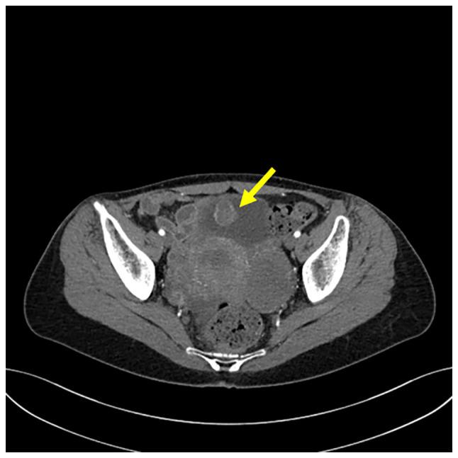 https://cdn.ncbi.nlm.nih.gov/pmc/blobs/0add/10157617/32e3aeb4fad8/ol-25-06-13813-g00.jpg