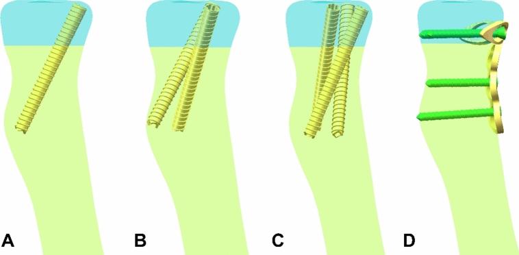 https://cdn.ncbi.nlm.nih.gov/pmc/blobs/0ade/11387503/f2f8dd49177f/41598_2024_70602_Fig5_HTML.jpg