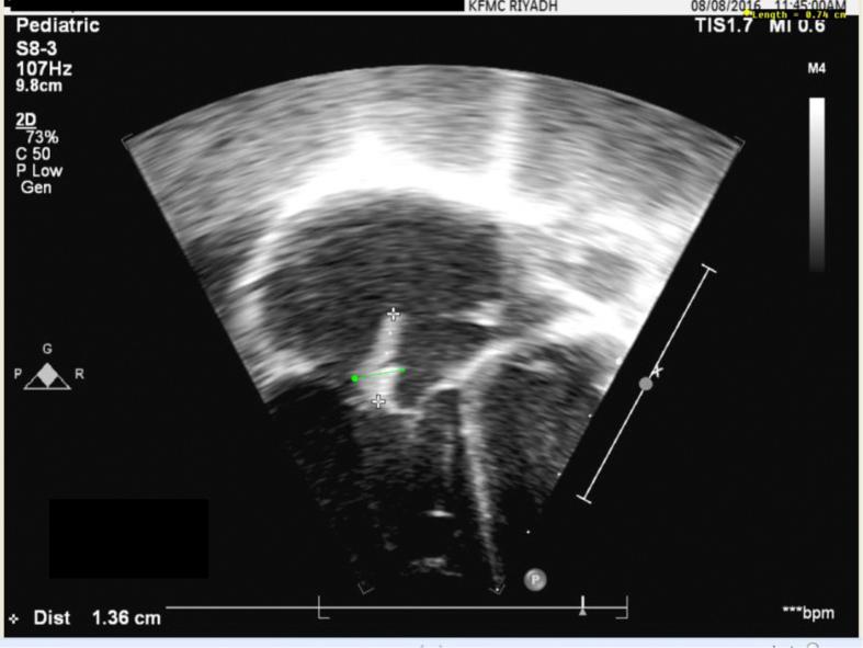 https://cdn.ncbi.nlm.nih.gov/pmc/blobs/0adf/6372568/be04386fdebb/gr2.jpg