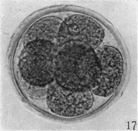 https://cdn.ncbi.nlm.nih.gov/pmc/blobs/0ae3/1272668/076df51e6c8d/janat00497-0044-e.jpg