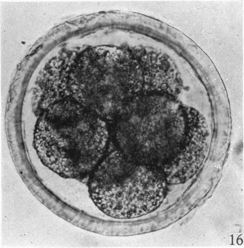 https://cdn.ncbi.nlm.nih.gov/pmc/blobs/0ae3/1272668/1ebd00594b1b/janat00497-0044-d.jpg