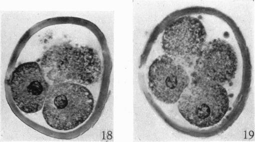 https://cdn.ncbi.nlm.nih.gov/pmc/blobs/0ae3/1272668/52620641f98e/janat00497-0044-f.jpg