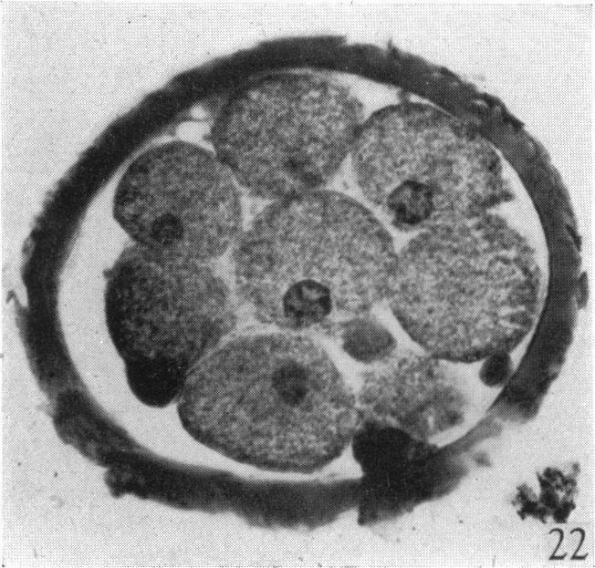 https://cdn.ncbi.nlm.nih.gov/pmc/blobs/0ae3/1272668/b75e447d0422/janat00497-0045-c.jpg