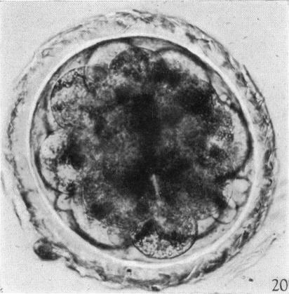 https://cdn.ncbi.nlm.nih.gov/pmc/blobs/0ae3/1272668/ddbe5179cc7e/janat00497-0045-a.jpg
