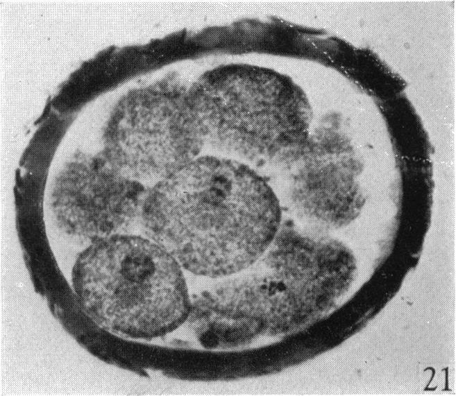 https://cdn.ncbi.nlm.nih.gov/pmc/blobs/0ae3/1272668/edf3660e7509/janat00497-0045-b.jpg