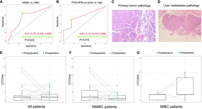 https://cdn.ncbi.nlm.nih.gov/pmc/blobs/0ae5/8222714/a07feb02c964/fonc-11-701298-g005.jpg