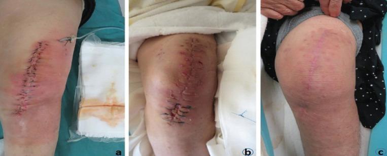 https://cdn.ncbi.nlm.nih.gov/pmc/blobs/0aec/11043989/122ce21a9752/JOCR-14-73-g003.jpg
