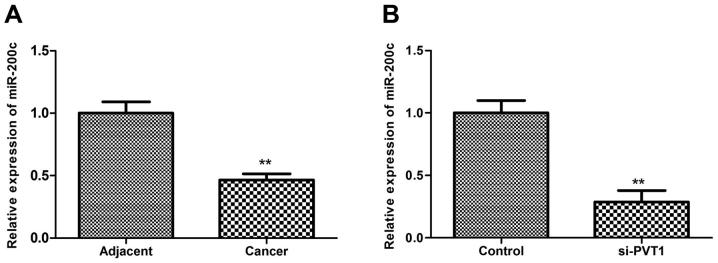 https://cdn.ncbi.nlm.nih.gov/pmc/blobs/0aef/5819911/004c792f195f/IJMM-41-03-1275-g03.jpg