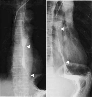 https://cdn.ncbi.nlm.nih.gov/pmc/blobs/0af9/4836191/bdfeccd11a59/12893_2016_137_Fig1_HTML.jpg