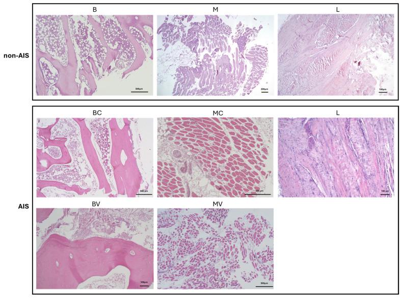 https://cdn.ncbi.nlm.nih.gov/pmc/blobs/0b01/12429667/0ab96df76b89/ijms-26-08453-g008.jpg
