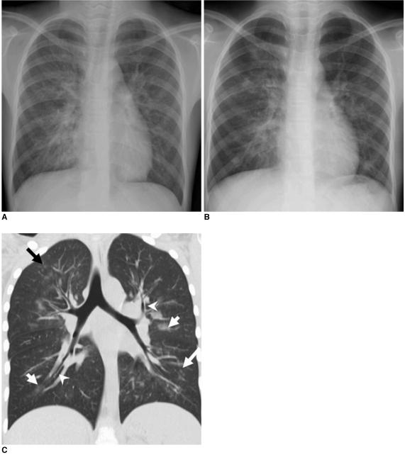https://cdn.ncbi.nlm.nih.gov/pmc/blobs/0b05/2974228/f7a5707fd409/kjr-11-656-g001.jpg