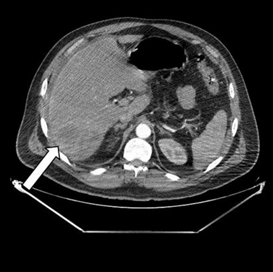 https://cdn.ncbi.nlm.nih.gov/pmc/blobs/0b09/10064683/8f686942489c/13256_2022_3676_Fig1_HTML.jpg