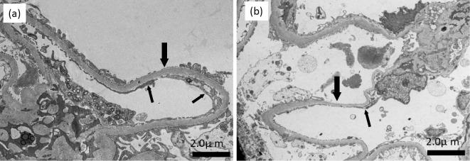 https://cdn.ncbi.nlm.nih.gov/pmc/blobs/0b0b/11557193/2c750368e31e/1349-7235-63-2821-g002.jpg