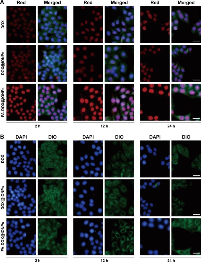 https://cdn.ncbi.nlm.nih.gov/pmc/blobs/0b0e/5834183/30f736cb5a81/ijn-13-1119Fig4.jpg