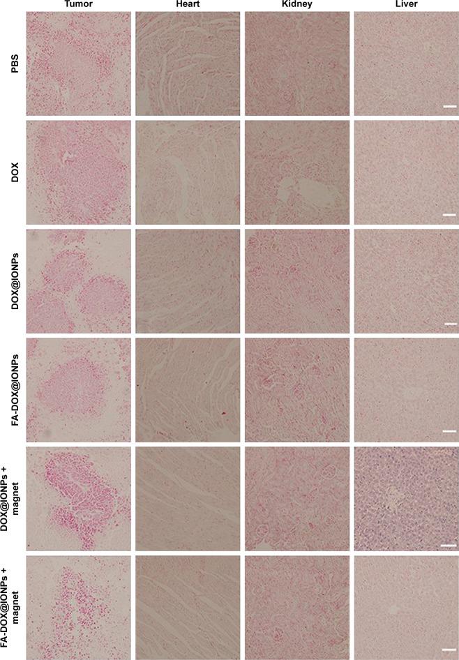 https://cdn.ncbi.nlm.nih.gov/pmc/blobs/0b0e/5834183/53677692cca7/ijn-13-1119Fig8.jpg