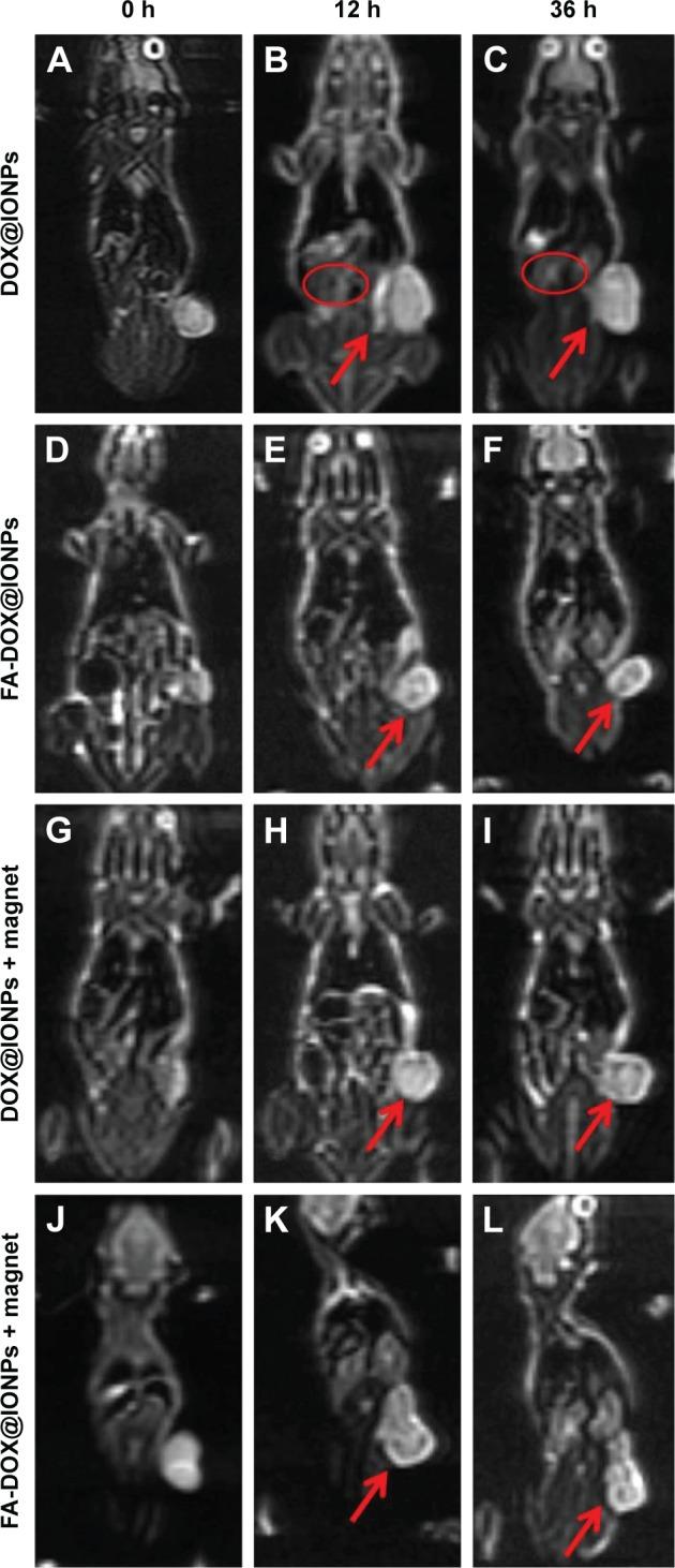 https://cdn.ncbi.nlm.nih.gov/pmc/blobs/0b0e/5834183/59b847a28e71/ijn-13-1119Fig9.jpg