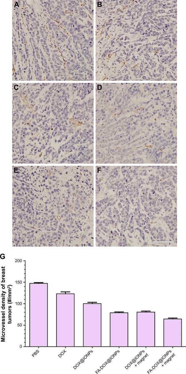 https://cdn.ncbi.nlm.nih.gov/pmc/blobs/0b0e/5834183/8d8e829fa0bd/ijn-13-1119Fig10.jpg