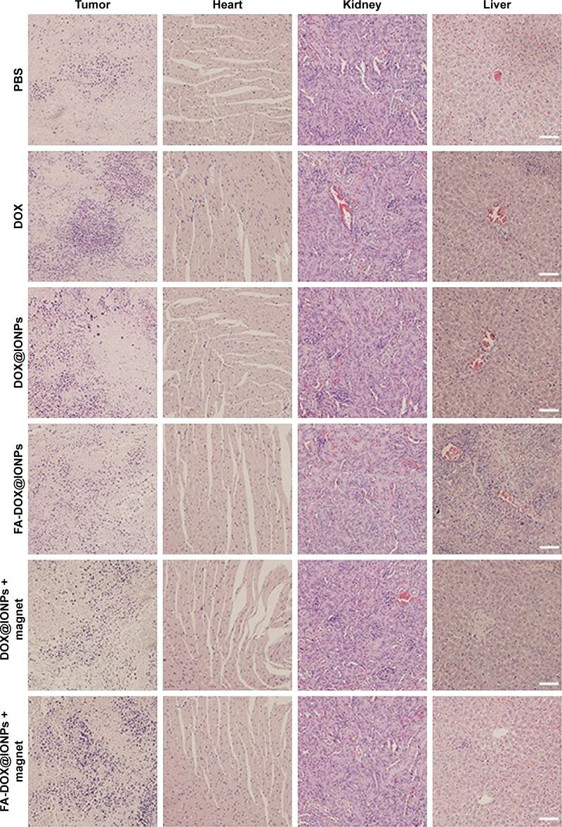 https://cdn.ncbi.nlm.nih.gov/pmc/blobs/0b0e/5834183/9861a75a7500/ijn-13-1119Fig7.jpg