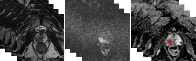 https://cdn.ncbi.nlm.nih.gov/pmc/blobs/0b0f/7890009/2e982915ba92/fonc-10-604266-g002.jpg