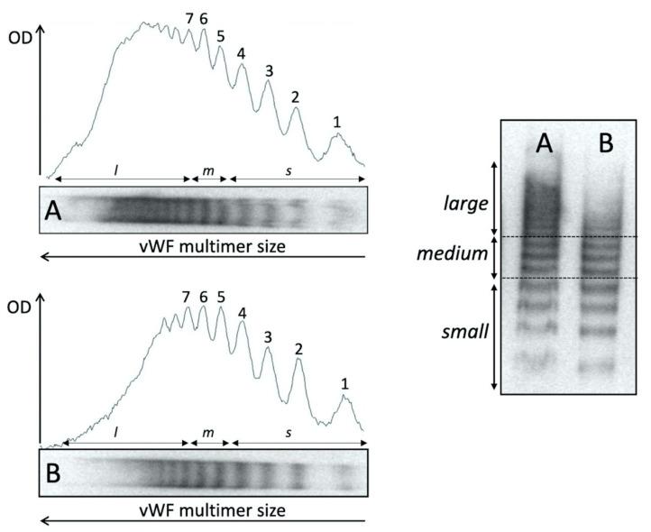 https://cdn.ncbi.nlm.nih.gov/pmc/blobs/0b12/8069424/367da37a844e/entropy-23-00447-g003.jpg