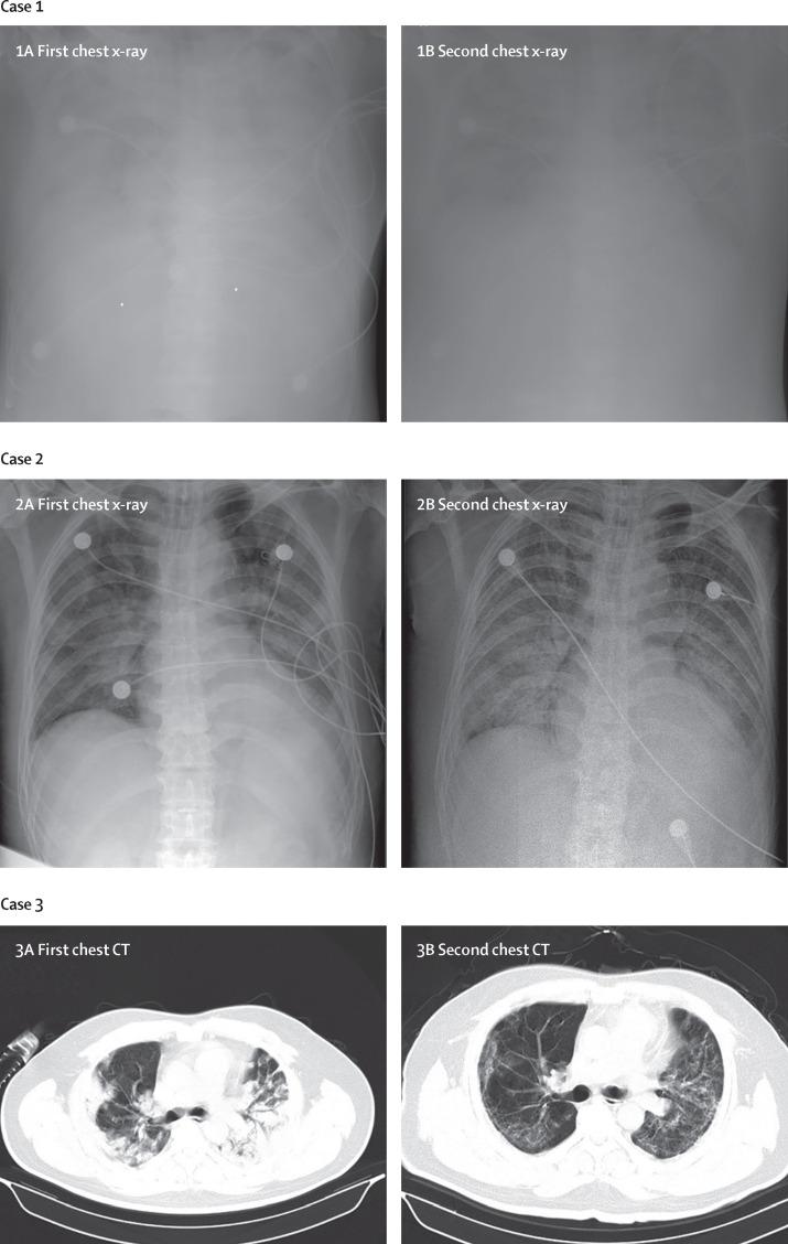 https://cdn.ncbi.nlm.nih.gov/pmc/blobs/0b1a/7135076/9ac8f6175816/gr1_lrg.jpg