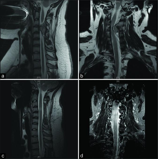 https://cdn.ncbi.nlm.nih.gov/pmc/blobs/0b1b/7110287/56c731a9942a/SNI-11-51-g001.jpg