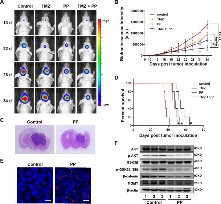 https://cdn.ncbi.nlm.nih.gov/pmc/blobs/0b1c/8511032/a4f1eb038cdd/41420_2021_654_Fig7_HTML.jpg