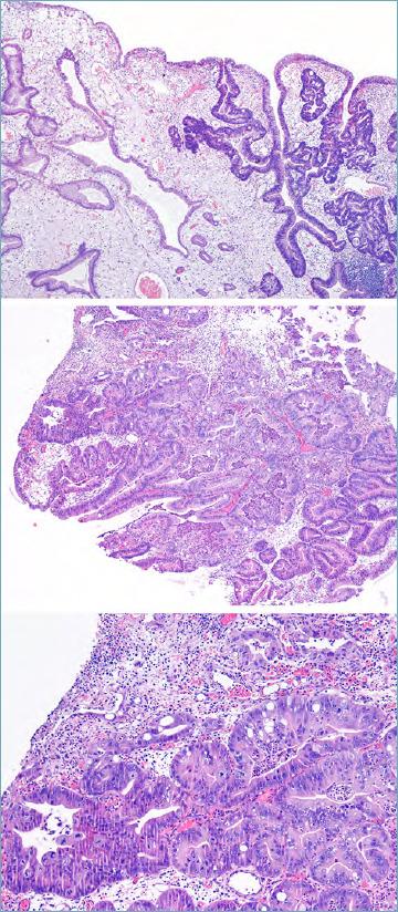https://cdn.ncbi.nlm.nih.gov/pmc/blobs/0b24/7931572/23b3252f1c95/pathol-2020-03-166-g003.jpg
