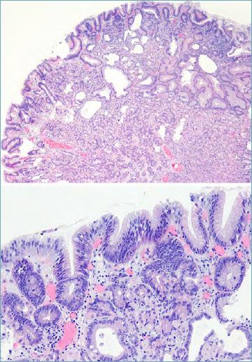 https://cdn.ncbi.nlm.nih.gov/pmc/blobs/0b24/7931572/71a283c6f47f/pathol-2020-03-166-g004.jpg