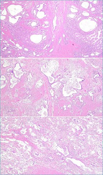 https://cdn.ncbi.nlm.nih.gov/pmc/blobs/0b24/7931572/8b615d7ef4ab/pathol-2020-03-166-g007.jpg