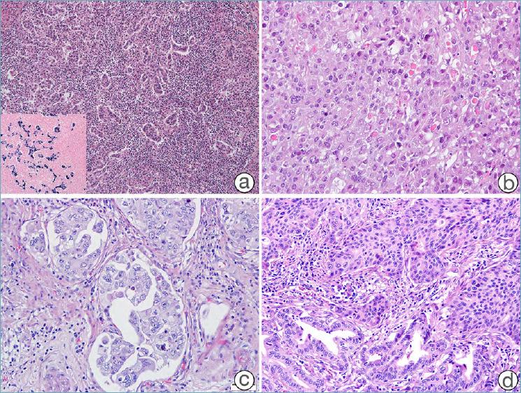 https://cdn.ncbi.nlm.nih.gov/pmc/blobs/0b24/7931572/b31e4d971c6e/pathol-2020-03-166-g006.jpg