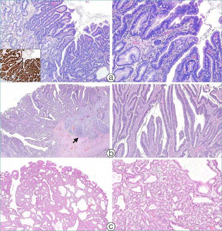 https://cdn.ncbi.nlm.nih.gov/pmc/blobs/0b24/7931572/f1a88a075186/pathol-2020-03-166-g002.jpg