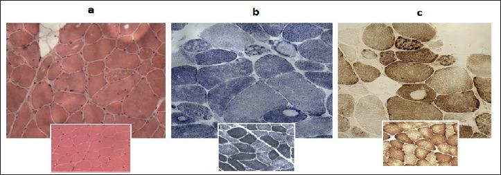 https://cdn.ncbi.nlm.nih.gov/pmc/blobs/0b27/6598407/448d9f3aa44f/am-2019-01-8-g001.jpg